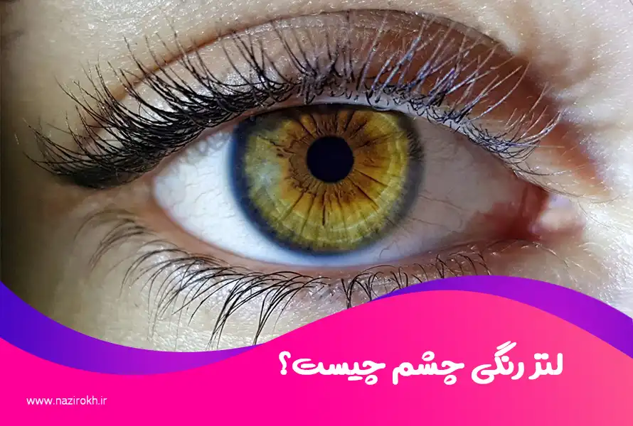 لنز رنگی چشم چیست؟