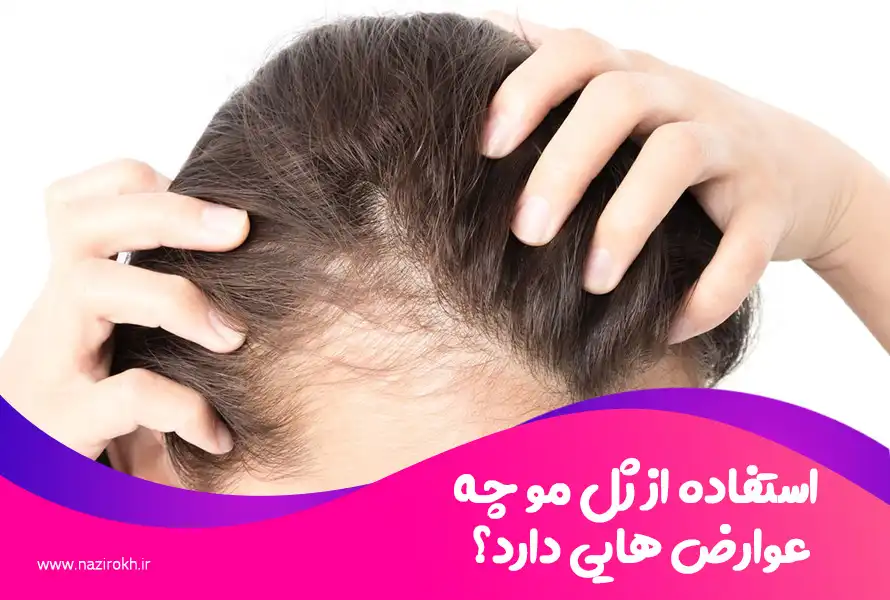 استفاده از ژل مو چه عوارض هایی دارد؟
