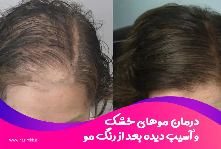 درمان موهای خشک و آسیب دیده بعد از رنگ مو
