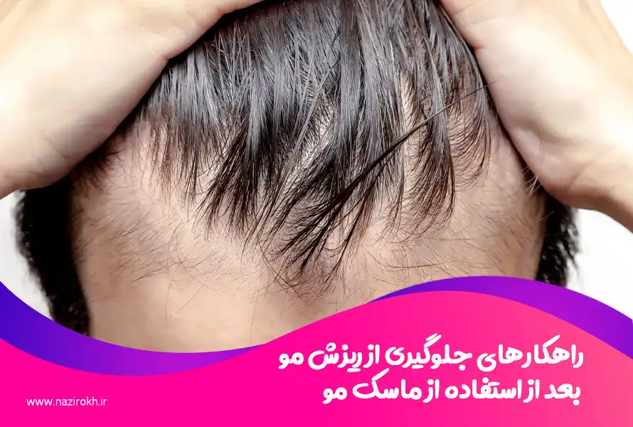راهکارهای جلوگیری از ریزش مو بعد از استفاده از ماسک مو